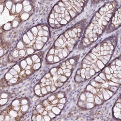 ZFYVE27 Antibody, Novus Biologicals 0.1mL; Unlabeled:Antibodies, Polyclonal