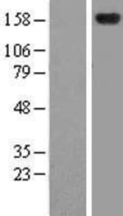 Novus Biologicals™ ZFYVE9 Overexpression Lysate