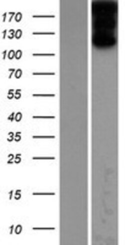 Novus Biologicals&trade;&nbsp;ZFYVE9 Overexpression Lysate