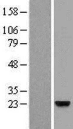 Novus Biologicals&trade;&nbsp;PAUF/ZG16B Overexpression Lysate