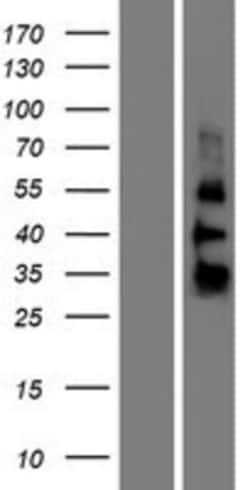 Novus Biologicals&trade;&nbsp;ZGLP1 Overexpression Lysate