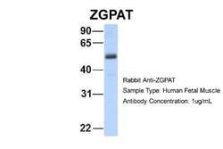 ZGPAT Antibody, Novus Biologicals 100μL; Unlabeled:Antibodies, Polyclonal