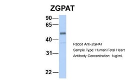 ZGPAT Antibody, Novus Biologicals 100μL; Unlabeled:Antibodies, Polyclonal