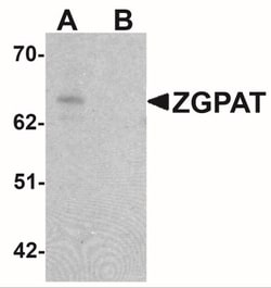 ZGPAT Antibody - BSA Free, Novus Biologicals 0.1mg; Unlabeled:Antibodies,