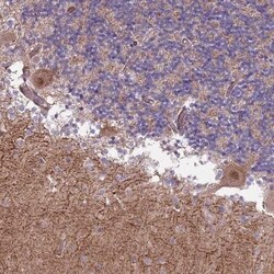 Zhangfei Antibody, Novus Biologicals 25 &mu;L, Unlabeled:Antibodies, Polyclonal