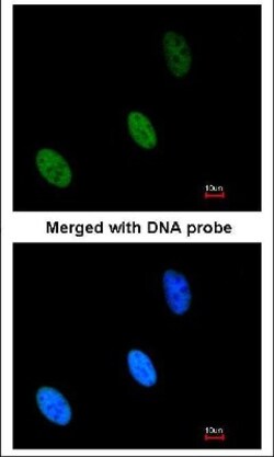 ZHX2 Antibody, Novus Biologicals 0.1mL; Unlabeled:Antibodies, Polyclonal