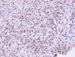 ZHX2 Antibody, Novus Biologicals 0.1mL; Unlabeled:Antibodies, Polyclonal