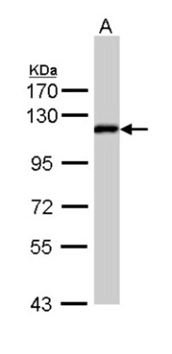 ZHX2 Antibody, Novus Biologicals 0.1mL; Unlabeled:Antibodies, Polyclonal
