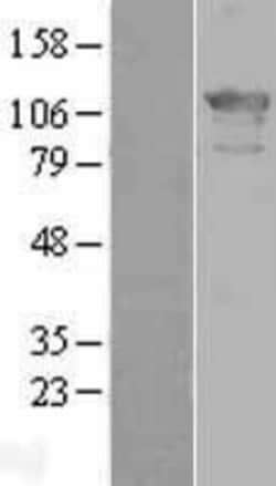 Novus Biologicals™ ZHX2 Overexpression Lysate