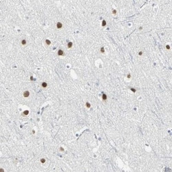 ZIC1 Antibody, Novus Biologicals:Antibodies:Primary Antibodies