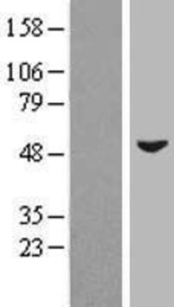 Novus Biologicals&trade;&nbsp;ZIC3 Overexpression Lysate
