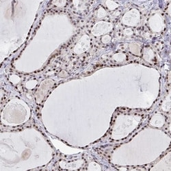 ZIC3 Antibody, Novus Biologicals 0.1mL; Unlabeled:Antibodies, Polyclonal