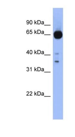 ZIC4 Antibody, Novus Biologicals 100&mu;L; Unlabeled:Antibodies, Polyclonal