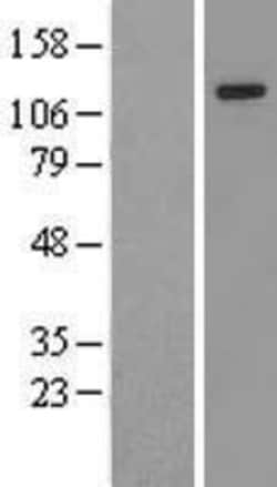 Novus Biologicals™ ZMIZ1/Zimp10 Overexpression Lysate