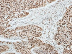 Zinc finger and BTB domain-containing protein 9 Antibody, Novus Biologicals