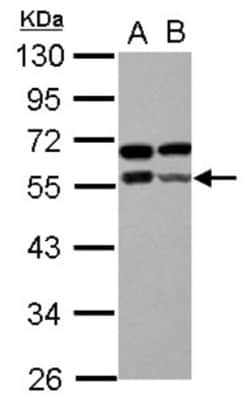 Zinc finger and BTB domain-containing protein 9 Antibody, Novus Biologicals
