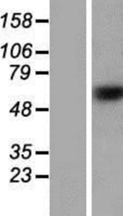 Novus Biologicals&trade;&nbsp;Zinc finger protein 774 Overexpression Lysate
