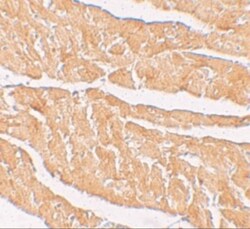 Zinc finger and BTB domain-containing protein 9 Antibody - BSA Free, Novus