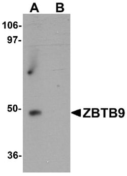 Zinc finger and BTB domain-containing protein 9 Antibody - BSA Free, Novus