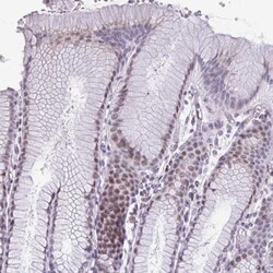 Zinc finger protein 682 Antibody, Novus Biologicals:Antibodies:Primary