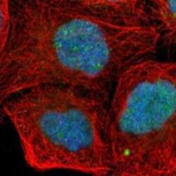 Zinc finger protein 773 Antibody, Novus Biologicals 25 &mu;L, Unlabeled:Antibodies,