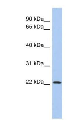 Zinc finger protein 833 Antibody, Novus Biologicals 100 &mu;L | Buy Online | Novus Biologicals | Fisher Scientific