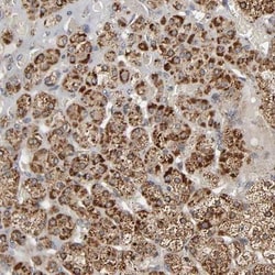 Zinc transporter 9 Antibody, Novus Biologicals:Antibodies:Primary Antibodies