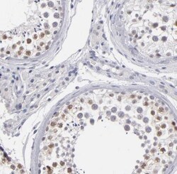 ZIP4H/Tex11 Antibody, Novus Biologicals 25 &mu;L; Unlabeled:Antibodies,