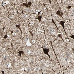 ZKSCAN1 Antibody, Novus Biologicals 25 &mu;L; Unlabeled:Antibodies, Polyclonal