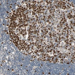 ZKSCAN3 Antibody, Novus Biologicals:Antibodies:Primary Antibodies
