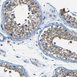 ZMAT1 Antibody, Novus Biologicals:Antibodies:Primary Antibodies