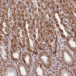 Zmat2 Antibody, Novus Biologicals 0.1 mL | Buy Online | Novus Biologicals | Fisher Scientific