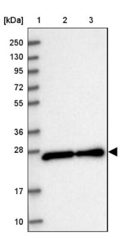 Zmat2 Antibody, Novus Biologicals 0.1 mL | Buy Online | Novus Biologicals | Fisher Scientific