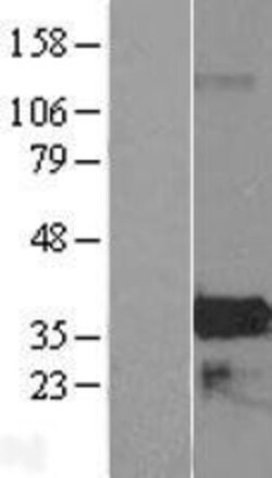 Novus Biologicals&trade;&nbsp;ZMAT4 Overexpression Lysate