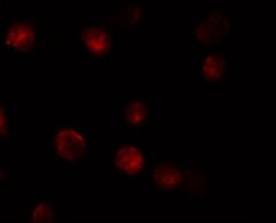 ZMIZ1/Zimp10 Antibody - BSA Free, Novus Biologicals 0.1mg; Unlabeled:Antibodies,