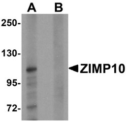 ZMIZ1/Zimp10 Antibody - BSA Free, Novus Biologicals 0.1mg; Unlabeled:Antibodies,
