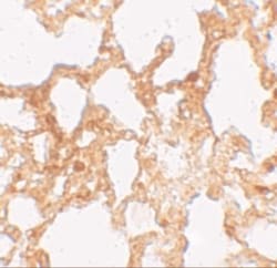 ZMYM1 Antibody - BSA Free, Novus Biologicals 0.1mg; Unlabeled:Antibodies,