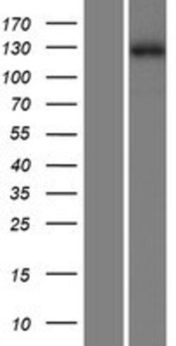 Novus Biologicals&trade;&nbsp;ZMYM1 Overexpression Lysate
