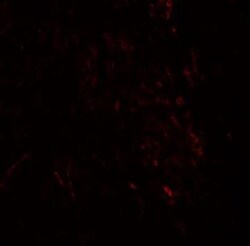 ZMYM3 Antibody - BSA Free, Novus Biologicals 0.1mg; Unlabeled:Antibodies,