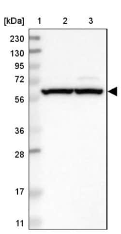 ZMYM5 Antibody, Novus Biologicals 0.1mL; Unlabeled:Antibodies, Polyclonal