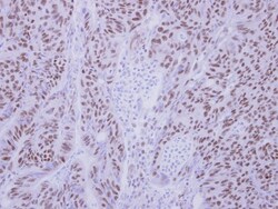 ZMYND11 Antibody, Novus Biologicals 0.1mL; Unlabeled:Antibodies, Polyclonal