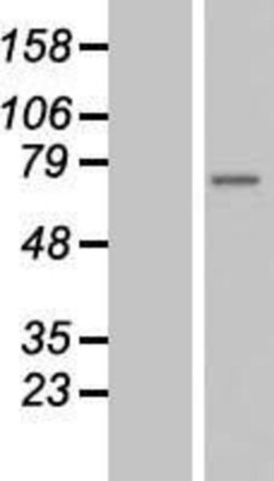 Novus Biologicals&trade;&nbsp;ZMYND11 Overexpression Lysate