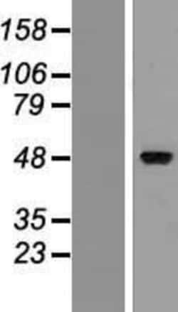 Novus Biologicals&trade;&nbsp;ZMYND17 Overexpression Lysate