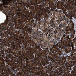 ZMYND19 Antibody, Novus Biologicals 25 &mu;L; Unlabeled:Antibodies, Polyclonal