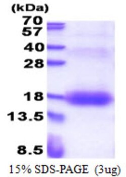 Novus Biologicals&trade;&nbsp;Recombinant Human ZNDR1 His Protein