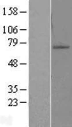 Novus Biologicals™ ZNF10 Overexpression Lysate