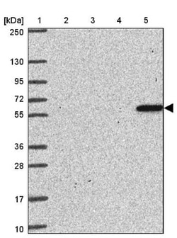 ZNF100 Antibody, Novus Biologicals 25 &mu;L, Unlabeled:Antibodies, Polyclonal