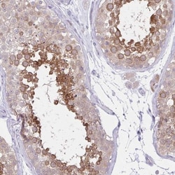 ZNF101 Antibody, Novus Biologicals 0.1mL; Unlabeled:Antibodies, Polyclonal