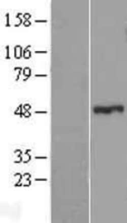 Novus Biologicals&trade;&nbsp;ZNF114 Overexpression Lysate