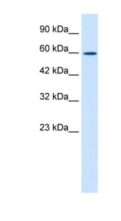 ZNF12 Antibody, Novus Biologicals 100&mu;L; Unlabeled:Antibodies, Polyclonal